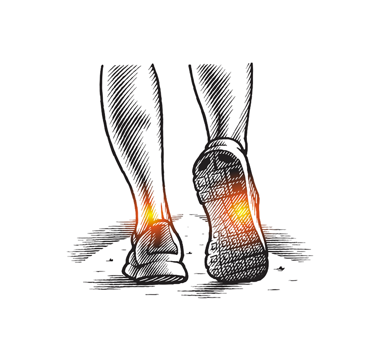 A pen and ink drawing showing foot and ankle pain.